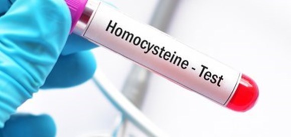  בדיקת הומוציסטאין Homocysteine - תמונה